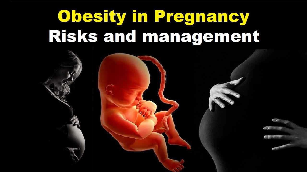 Obesity in Pregnancy Risks and management